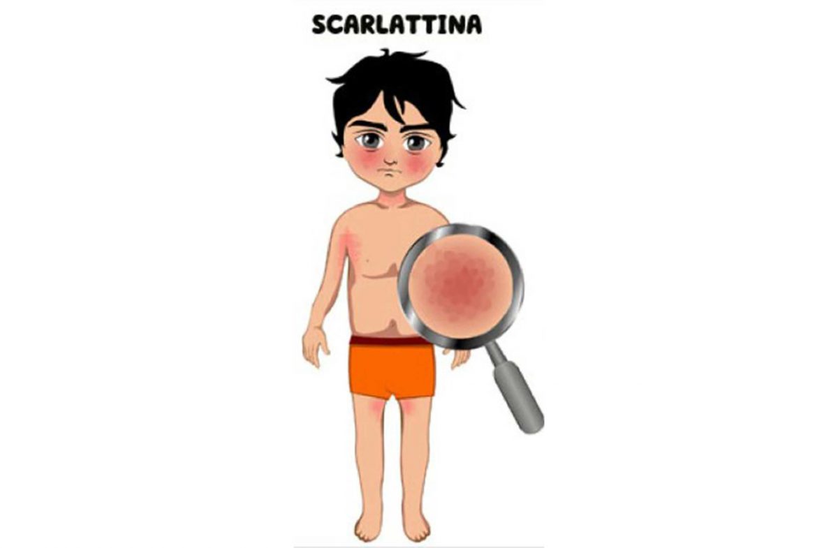 primary-care-scarlattina-1200x785.jpg